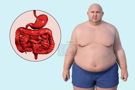Téléchargez les photos : Illustration médicale 3D détaillée d'un homme en surpoids à la peau transparente, révélant le système digestif et soulignant les problèmes digestifs associés à l'obésité. - en image libre de droit