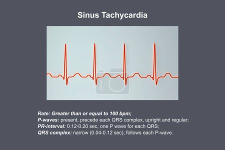 Photo for Electrocardiogram (ECG) displaying sinus tachycardia, a regular cardiac rhythm with heart rate that is higher than the upper limit of normal of 90-100 bpm in adults, 3D illustration. - Royalty Free Image