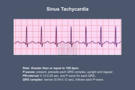Photo for Electrocardiogram (ECG) displaying sinus tachycardia, a regular cardiac rhythm with heart rate that is higher than the upper limit of normal of 90-100 bpm in adults, 3D illustration. - Royalty Free Image