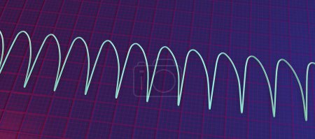 Téléchargez les photos : Tachycardie ventriculaire : Rythme cardiaque rapide provenant des ventricules, qui provoque des palpitations, des étourdissements, des symptômes potentiellement mortels. ECG montre des complexes QRS larges, illustration 3D. - en image libre de droit