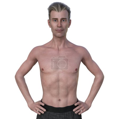 Téléchargez les photos : Une illustration photoréaliste 3D montrant la moitié supérieure d'un homme d'âge moyen de poids normal - en image libre de droit