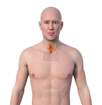 Foto de Anatomía de la glándula tiroides. Ilustración 3D mostrando a un hombre con piel transparente, revelando una glándula tiroides. - Imagen libre de derechos