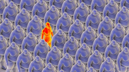 Foto de Una sola persona de peso normal apenas visible en medio de un gran grupo de personas con sobrepeso idénticas, ilustración conceptual en 3D que destaca los desafíos de la conciencia de la obesidad y las disparidades de salud.. - Imagen libre de derechos
