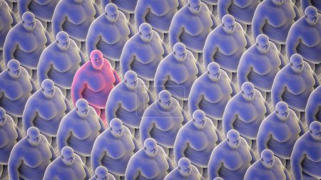 Téléchargez les photos : Cloné personnes en surpoids debout d'une manière organisée avec une personne regardant la caméra, illustration 3D symbolisant l'épidémie d'obésité et la conscience de la santé. - en image libre de droit