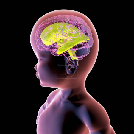 Téléchargez les photos : Illustration 3D scientifique d'un bébé présentant une macrocéphalie et des ventricules cérébraux élargis, une condition associée à une croissance anormale du cerveau. - en image libre de droit