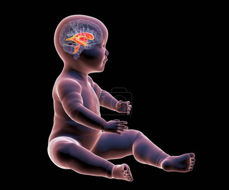 Foto de Un bebé con un cerebro normal y ventrículos cerebrales de tamaño apropiado, ilustración 3D. - Imagen libre de derechos