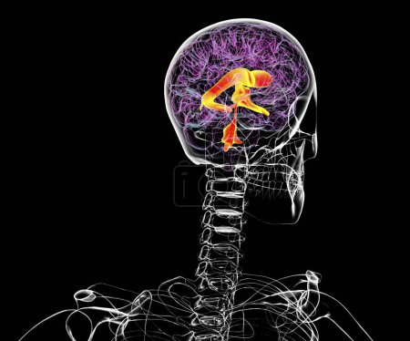 Foto de Sistema ventricular del cerebro, ilustración 3D. Los ventrículos son cavidades en el cerebro que están llenas de líquido cefalorraquídeo (LCR)). - Imagen libre de derechos