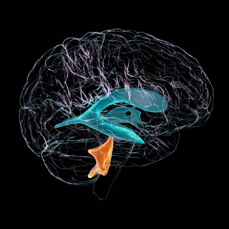 Foto de Una ilustración científica en 3D que representa el agrandamiento aislado del cuarto ventrículo cerebral, vista lateral. - Imagen libre de derechos