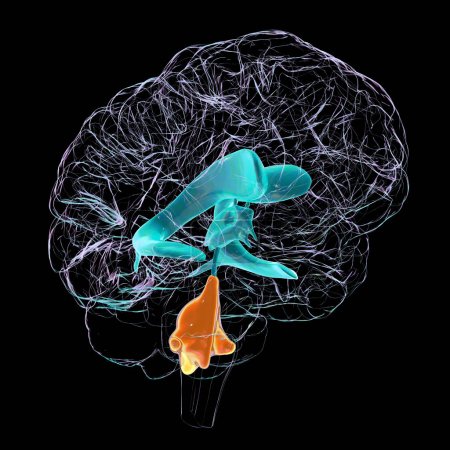 Foto de Una ilustración científica en 3D que representa el agrandamiento aislado del cuarto ventrículo cerebral. - Imagen libre de derechos