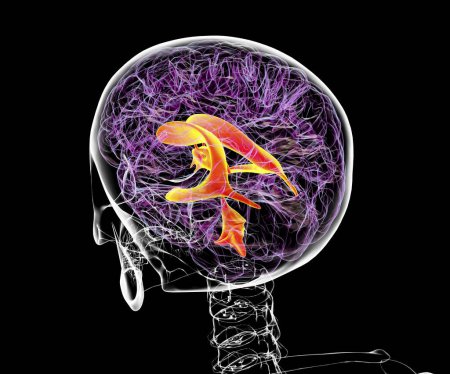 Téléchargez les photos : Système ventriculaire du cerveau, illustration 3D. Les ventricules sont des cavités cérébrales remplies de liquide céphalorachidien (LCR).). - en image libre de droit