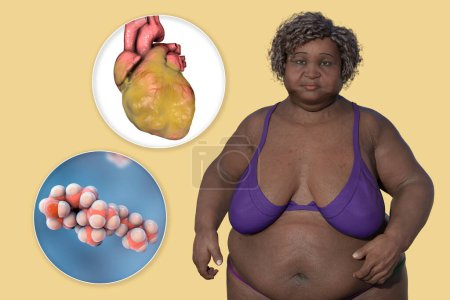 Foto de Molécula de colesterol y corazón obeso en la mujer con sobrepeso, ilustración 3D. Concepto de obesidad y enfermedad de los órganos internos debido a dislipidemia. - Imagen libre de derechos