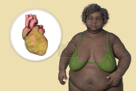 Photo for A 3D medical illustration of a senior overweight woman and close-up view of enlarged and obese heart. Concept of obesity and inner organs diseases. - Royalty Free Image