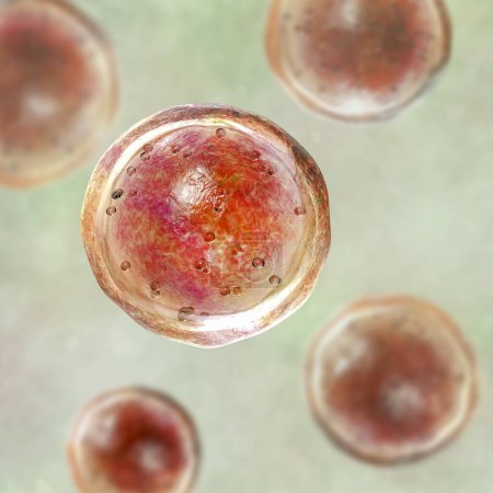 Foto de Emmonsia hongos microscópicos patógenos, etapa de la adiáspora, ilustración 3D. El agente causal de la enfermedad pulmonar por adiaspiromicosis en animales pequeños y raramente en humanos - Imagen libre de derechos