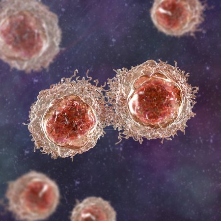 Foto de Células cancerosas, células malignas bajo el microscopio, ilustración 3D - Imagen libre de derechos