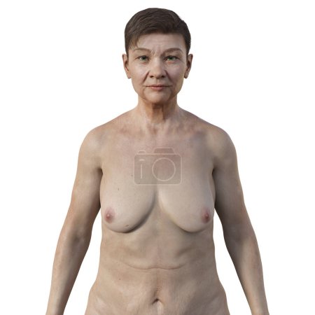 Téléchargez les photos : Illustration photoréaliste 3D représentant la moitié supérieure d'une femme âgée, révélant son vieillissement cutané, ses expressions faciales et son anatomie corporelle complexe - en image libre de droit