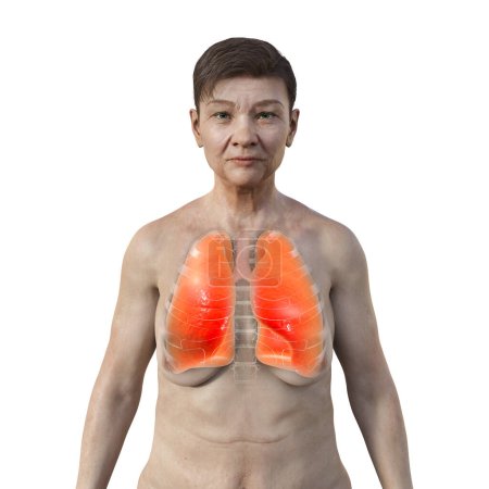 Foto de Una ilustración fotorrealista 3D de la mitad superior de una mujer mayor con piel transparente, mostrando un par de pulmones sanos en intrincados detalles. - Imagen libre de derechos