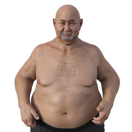 Foto de Una ilustración científica en 3D de un hombre mayor con sobrepeso, destacando la parte superior de su cuerpo y haciendo hincapié en las implicaciones de la obesidad en la salud. - Imagen libre de derechos