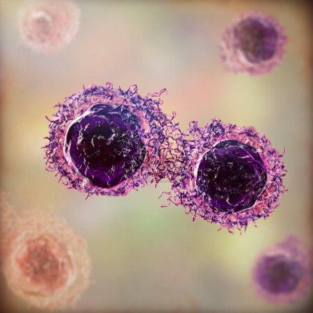Foto de Células cancerosas, células malignas bajo el microscopio, ilustración 3D - Imagen libre de derechos
