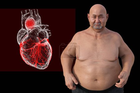 Photo for 3D scientific illustration depicting an obese man with transparent skin, revealing an ascending aortic aneurysm, a concept highlighting the association of ascending aortic aneurysm with obesity. - Royalty Free Image