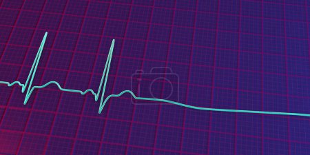 Foto de Asístole, una condición crítica marcada por la ausencia de actividad eléctrica cardiaca. La ilustración 3D muestra una línea plana en el ECG, lo que significa un corazón que no funciona sin pulso o latido del corazón. - Imagen libre de derechos