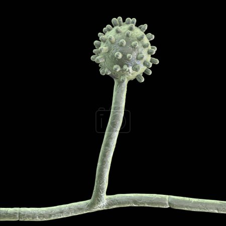 Foto de Histoplasma capsulatum, un parásito, hongo dimórfico tipo levadura que puede causar infección pulmonar histoplasmosis. Una ilustración en 3D muestra una forma micelial que se encuentra en el suelo enriquecido con excrementos animales. - Imagen libre de derechos