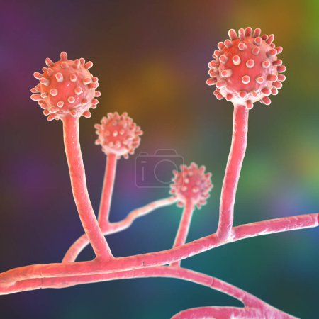 Foto de Histoplasma capsulatum, un parásito, hongo dimórfico tipo levadura que puede causar infección pulmonar histoplasmosis. Una ilustración en 3D muestra una forma micelial que se encuentra en el suelo enriquecido con excrementos animales. - Imagen libre de derechos