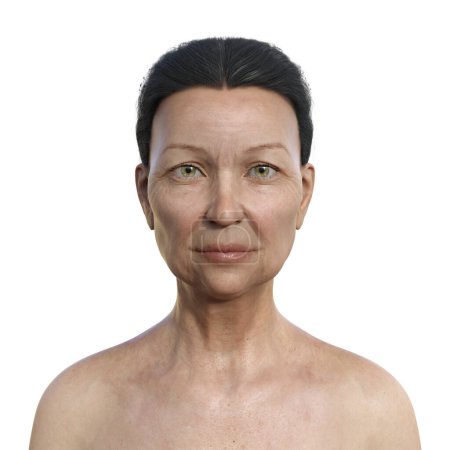 Téléchargez les photos : Illustration scientifique 3D photoréaliste représentant le portrait d'une femme âgée à la peau blanche, mettant l'accent sur son vieillissement cutané et ses traits anatomiques.. - en image libre de droit