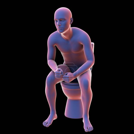 Téléchargez les photos : Illustration 3D représentant une personne souffrant de constipation assise sur une toilette, mettant en évidence un problème de santé commun. - en image libre de droit