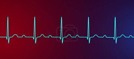 Photo for 3D illustration of an ECG displaying 1st degree AV block, a cardiac conduction disorder - Royalty Free Image