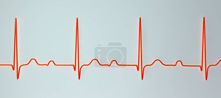 Foto de Ilustración 3D de un ECG que muestra bloqueo AV de primer grado, un trastorno de la conducción cardíaca - Imagen libre de derechos
