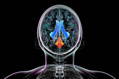 Foto de Una ilustración científica en 3D que representa el agrandamiento aislado del cuarto ventrículo cerebral, vista superior. - Imagen libre de derechos