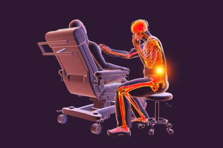 Photo pour Illustration 3D symbolisant les maladies professionnelles dans les soins de santé, mettant en vedette un médecin souffrant de maux de dos dus au stress lié au travail. - image libre de droit