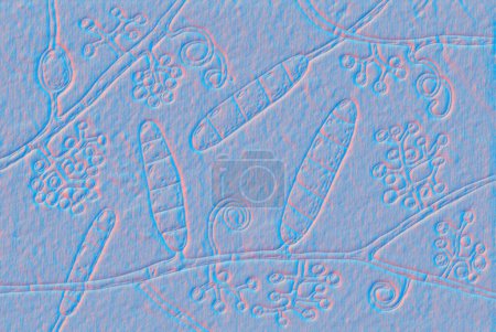 Téléchargez les photos : Champignons Trichophyton mentagrophytes, illustration 3D montrant des macroconidies, conidiophores ramifiés portant des conidies sphériques, hyphes septés et spiraux. Causes teigne, infections des cheveux et des ongles - en image libre de droit