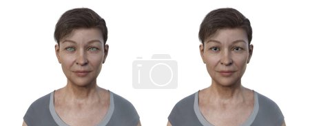 Téléchargez les photos : Une femme avec pupilles dilatées (droite) et rétrécies (gauche), illustration 3D. - en image libre de droit