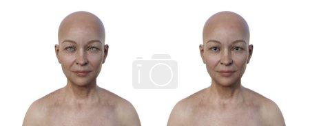 Téléchargez les photos : Une femme avec pupilles oculaires dilatées et resserrées, illustration 3D. - en image libre de droit
