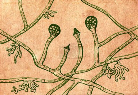 Foto de Ilustración dibujada a mano del complejo de hongos Lichtheimia corymbifera sobre papel envejecido, que recuerda a dibujos médicos medievales. Agente etiológico de la mucormicosis asociada a infecciones de heridas. - Imagen libre de derechos
