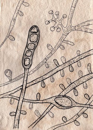 Téléchargez les photos : Illustration dessinée à la main de Trichophyton tonsurans champignons sur papier vieilli, rappelant les dessins médicaux médiévaux, fusionnant l'art avec la représentation mycologique. Un champignon causant des infections du cuir chevelu. - en image libre de droit