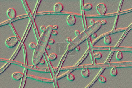 Foto de Hongo Trichophyton rubrum, ilustración 3D que muestra macroconidium, microconidios e hifas septas. Infecta la piel y las uñas causando dermatofitosis. - Imagen libre de derechos