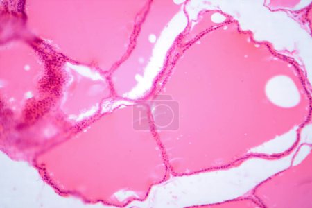 Téléchargez les photos : Photomicrographie d'une glande thyroïde normale au microscope, montrant une structure folliculaire typique et des follicules remplis de colloïdes. - en image libre de droit