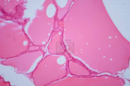 Fotomicrografía de una glándula tiroides normal bajo un microscopio, con estructura folicular típica y folículos llenos de coloides.
