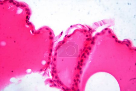 Téléchargez les photos : Photomicrographie d'une glande thyroïde normale au microscope, montrant une structure folliculaire typique et des follicules remplis de colloïdes. - en image libre de droit