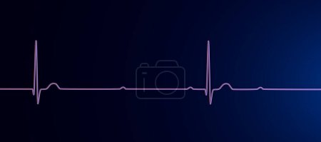 Téléchargez les photos : Illustration 3D visualisant un ECG avec bloc AV au 3ème degré, montrant une dissociation complète entre les rythmes auriculaire et ventriculaire. - en image libre de droit