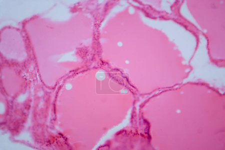 Foto de Fotomicrografía de una glándula tiroides normal bajo un microscopio, con estructura folicular típica y folículos llenos de coloides. - Imagen libre de derechos
