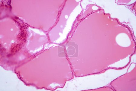 Photomicrographie d'une glande thyroïde normale au microscope, montrant une structure folliculaire typique et des follicules remplis de colloïdes.