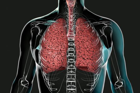 A person with smoker's lungs, 3D illustration of lungs affected by smoking.