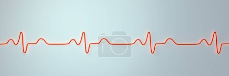 Photo for 3D illustration visualizing an ECG with Bundle branch block, showing widened QRS complexes, altered ventricular depolarization. - Royalty Free Image