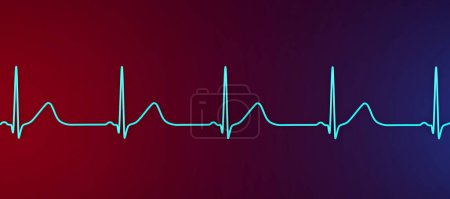 Téléchargez les photos : Illustration 3D d'un électrocardiogramme (ECG) montrant un intervalle QT prolongé avec des ondes T larges, caractéristique du syndrome QT long de type 1. - en image libre de droit