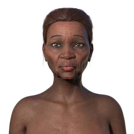 Téléchargez les photos : Illustration 3D détaillée de la vue de face d'une femme africaine âgée, mettant en valeur la texture de la peau et les caractéristiques anatomiques. - en image libre de droit