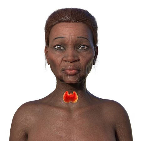 Detaillierte 3D-Illustration der Vorderseite einer älteren Afrikanerin mit hervorgehobener normaler Schilddrüse.