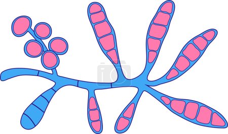 Illustration for Microscopic fungi Epidermophyton floccosum, scientific illustration. A filamentous fungus, causes skin and nail infections, such as athlete's foot, tinea cruris, tinea corporis and onychomycosis - Royalty Free Image